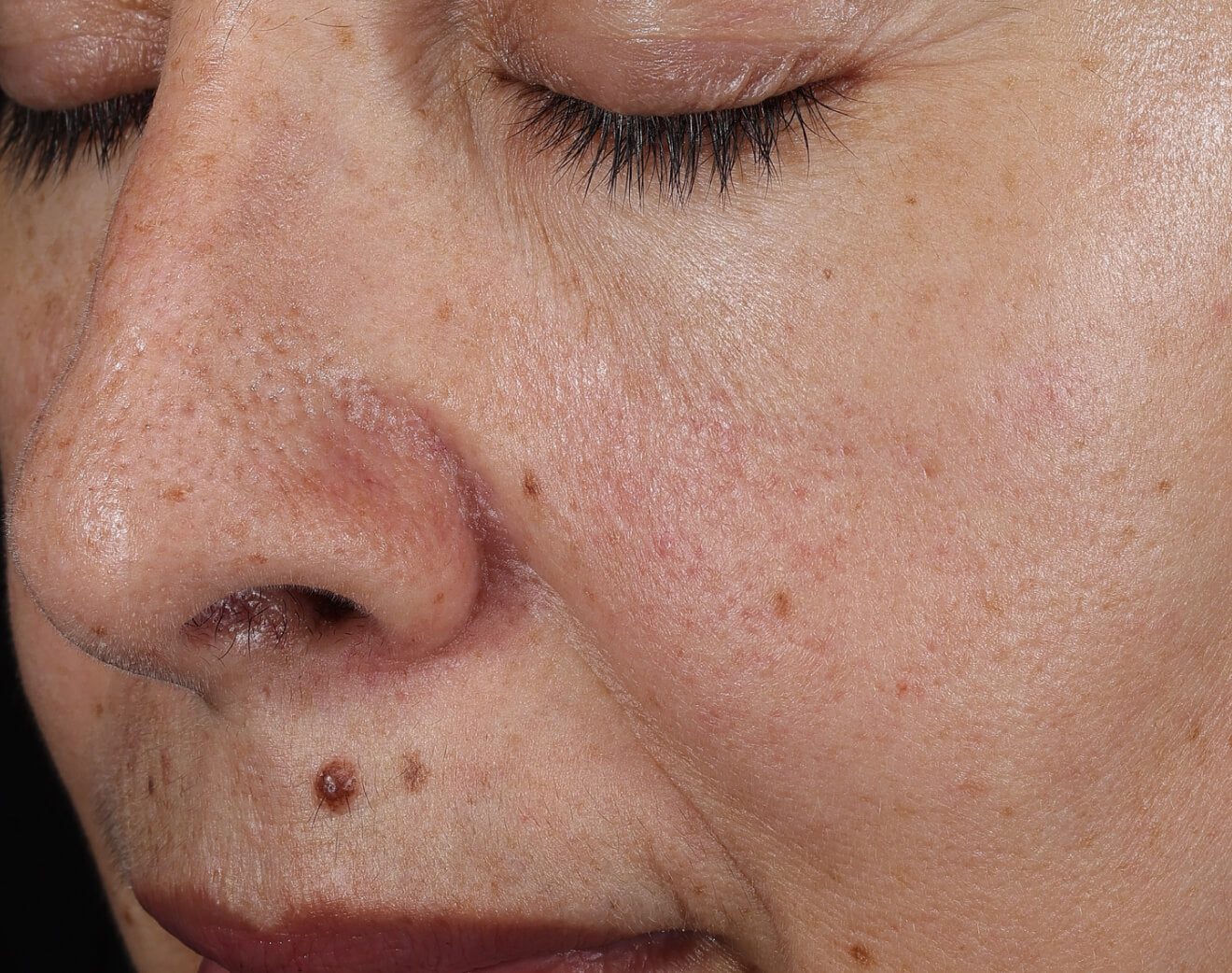 Omorovicza
