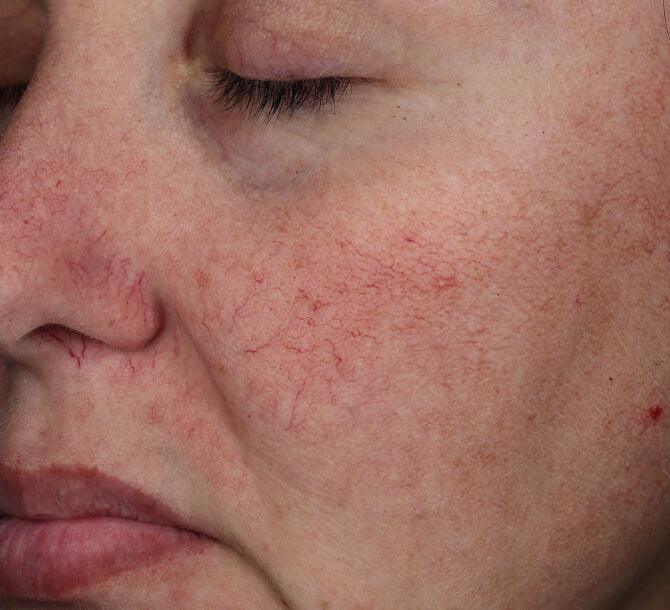 Omorovicza