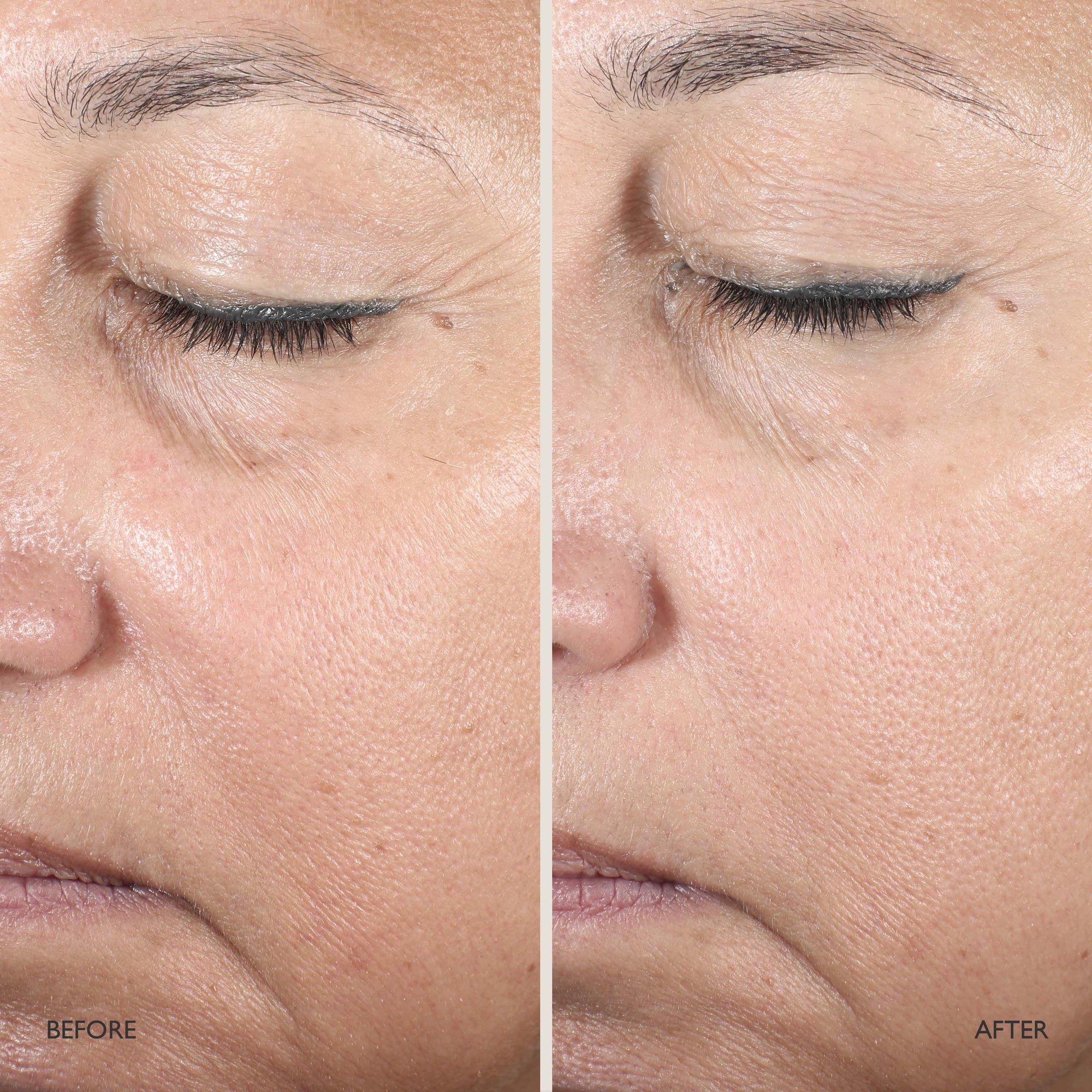 Queen Serum Mini