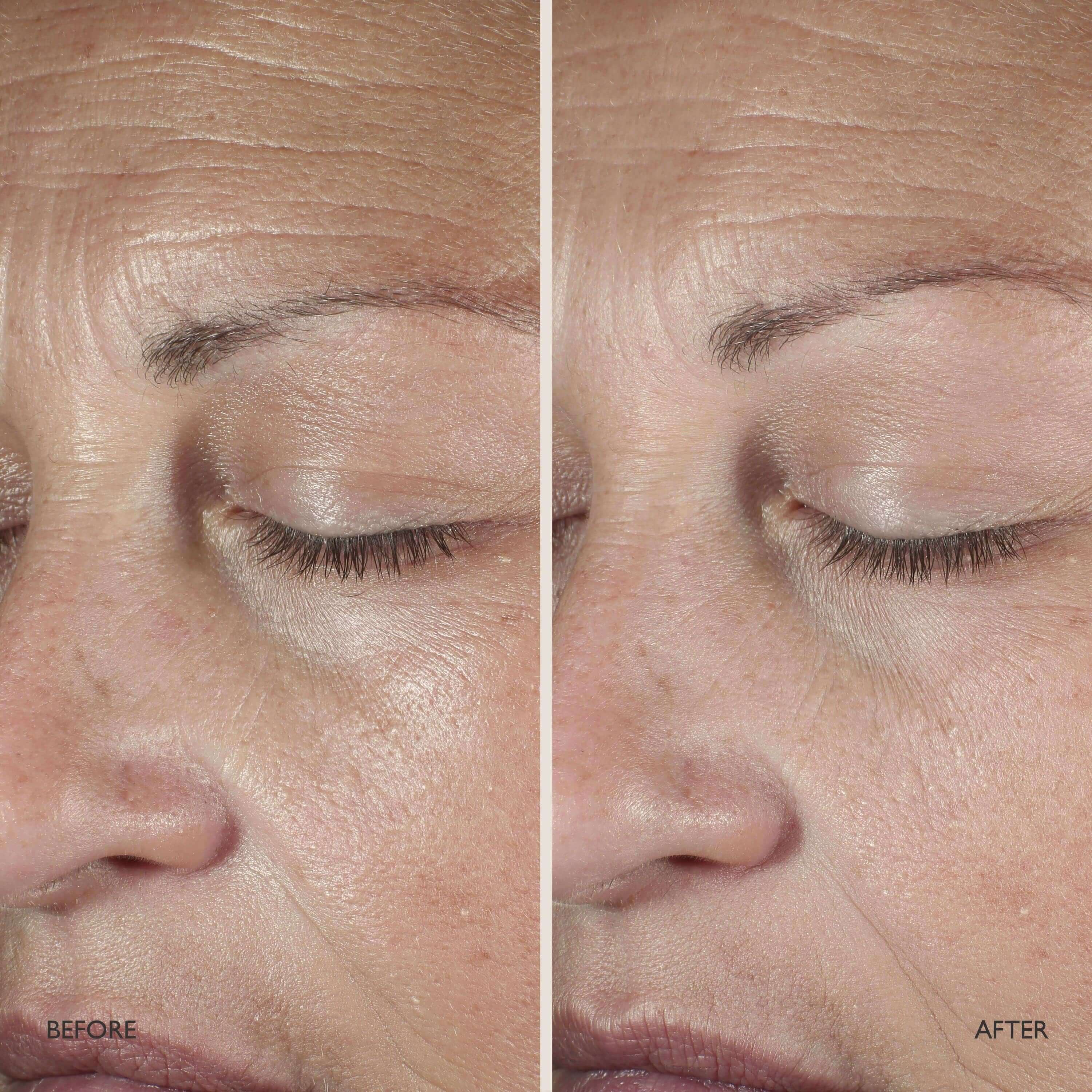 Queen Serum – Omorovicza