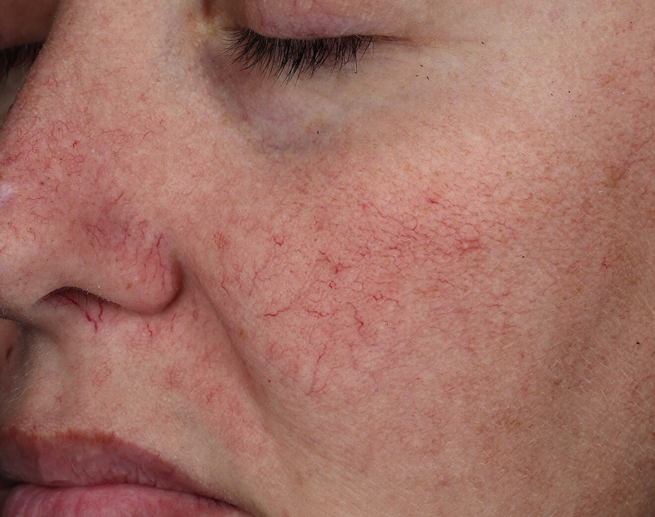 Omorovicza