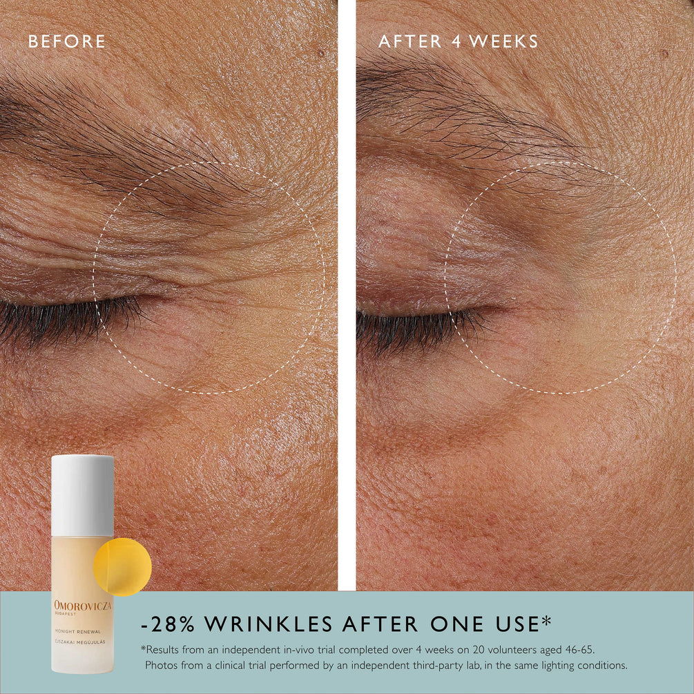 Omorovicza Midnight Renewal Before & After image of in vitro trial