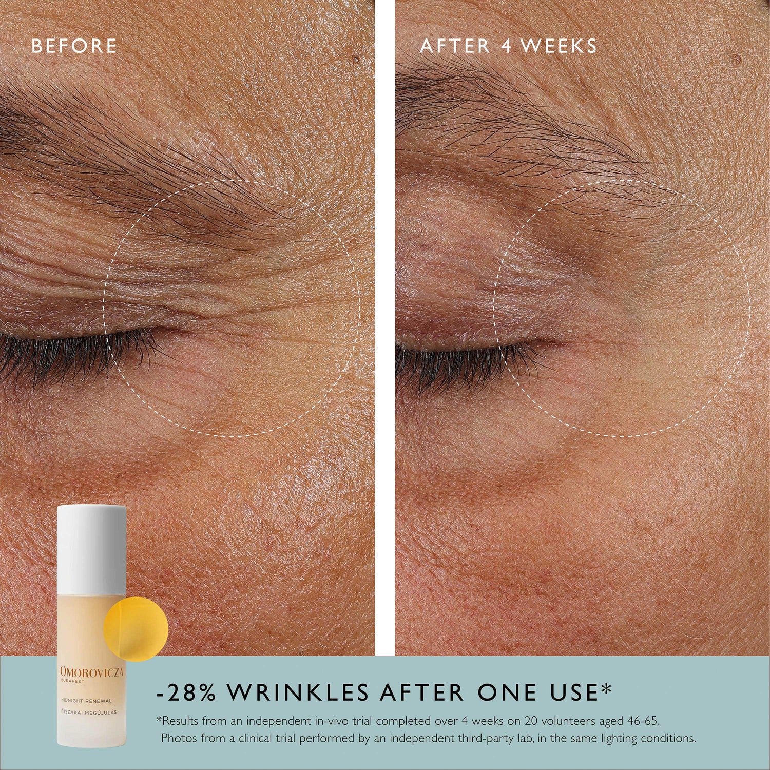 Omorovicza Midnight Renewal Before & After image of in vitro trial