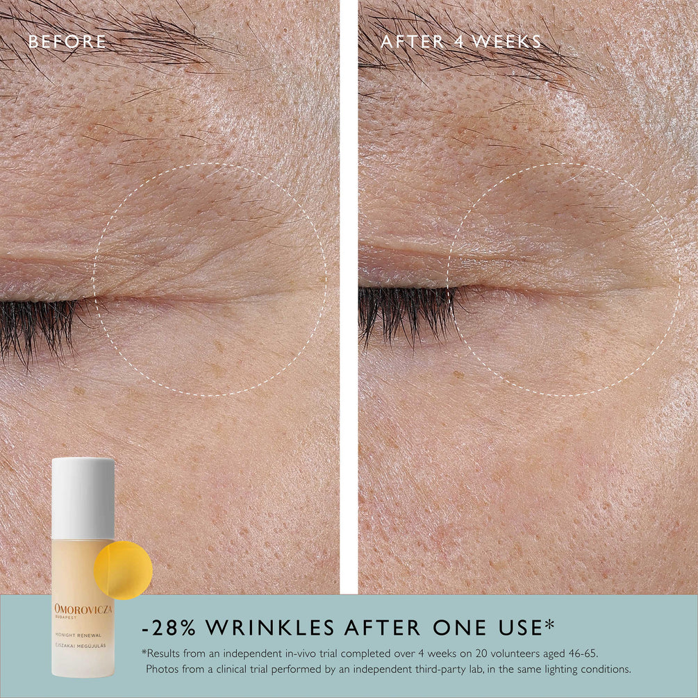 Omorovicza Midnight Renewal Before & After image of in vitro trial